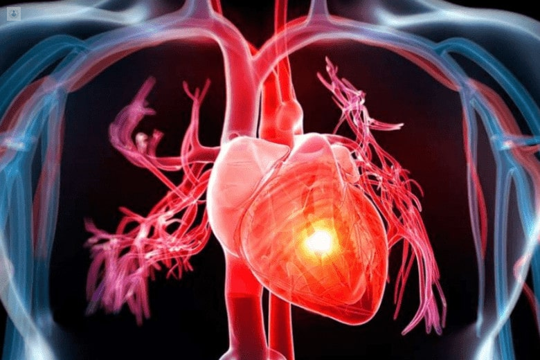 Cuando es necesario hacer una valoración preoperatoria